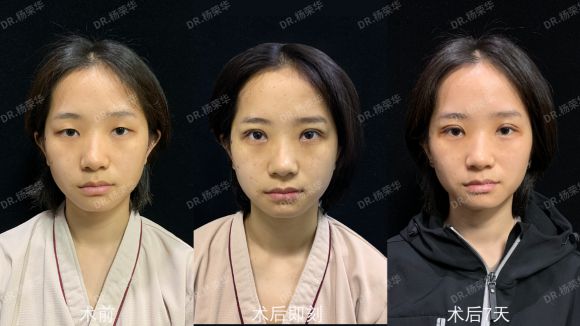 手机游戏冰袋-手机游戏：快节奏世界中的情绪释放器与快乐源泉