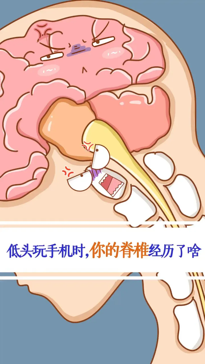 手机玩游戏伤颈椎吗头疼-手机游戏虽好玩，但长时间玩小心颈椎疼